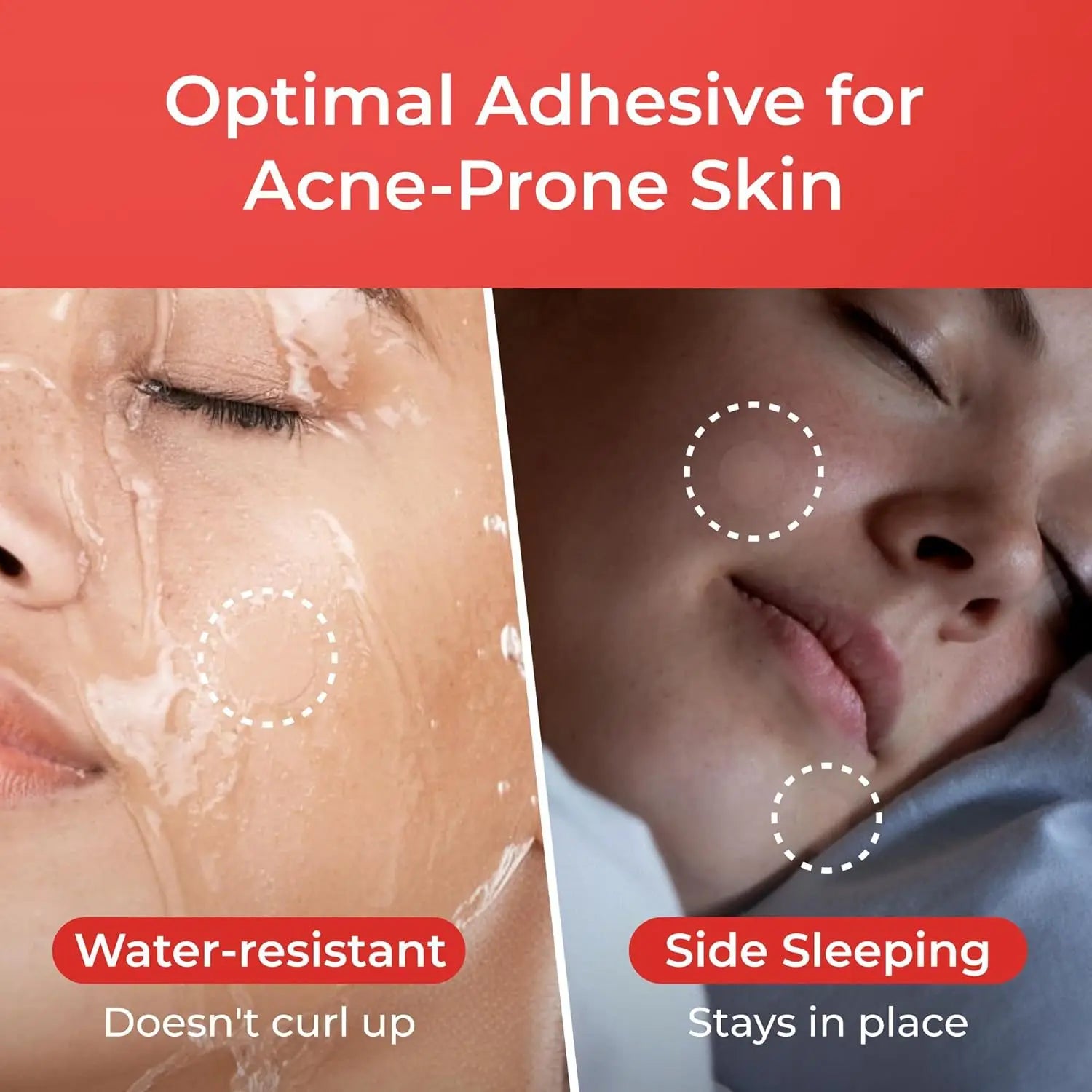 Invisible Acne Healing Dots